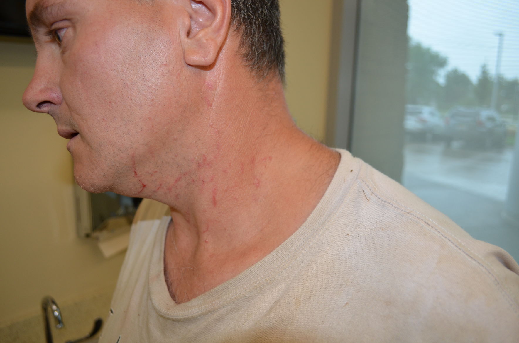 Todd Kendhammer's neck
